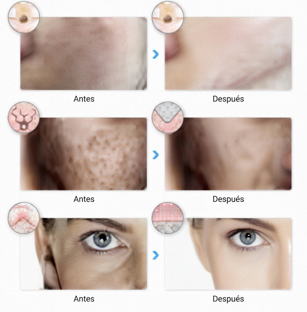 Máscara facial LED recargable de 7 colores