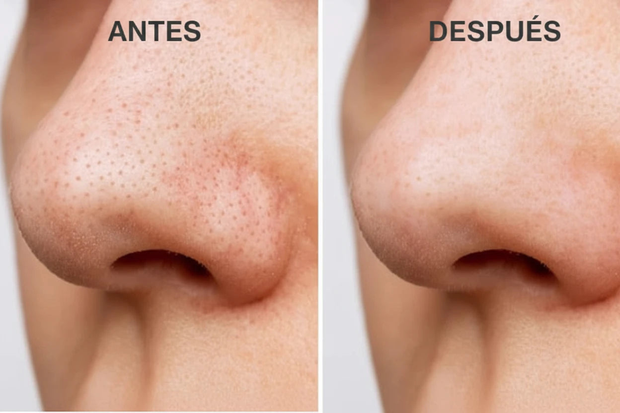 Limpiador Facial Ultrasónico - LA ROSÉ