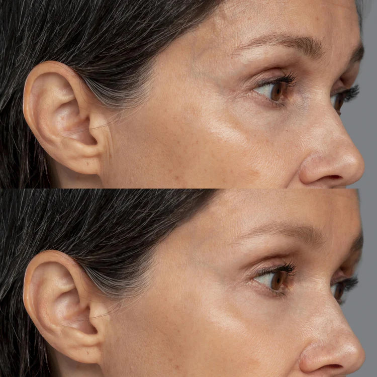 Máscara LED - LA ROSÉ