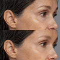 LumiDerm Pro